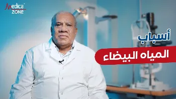 أسباب المياه البيضاء